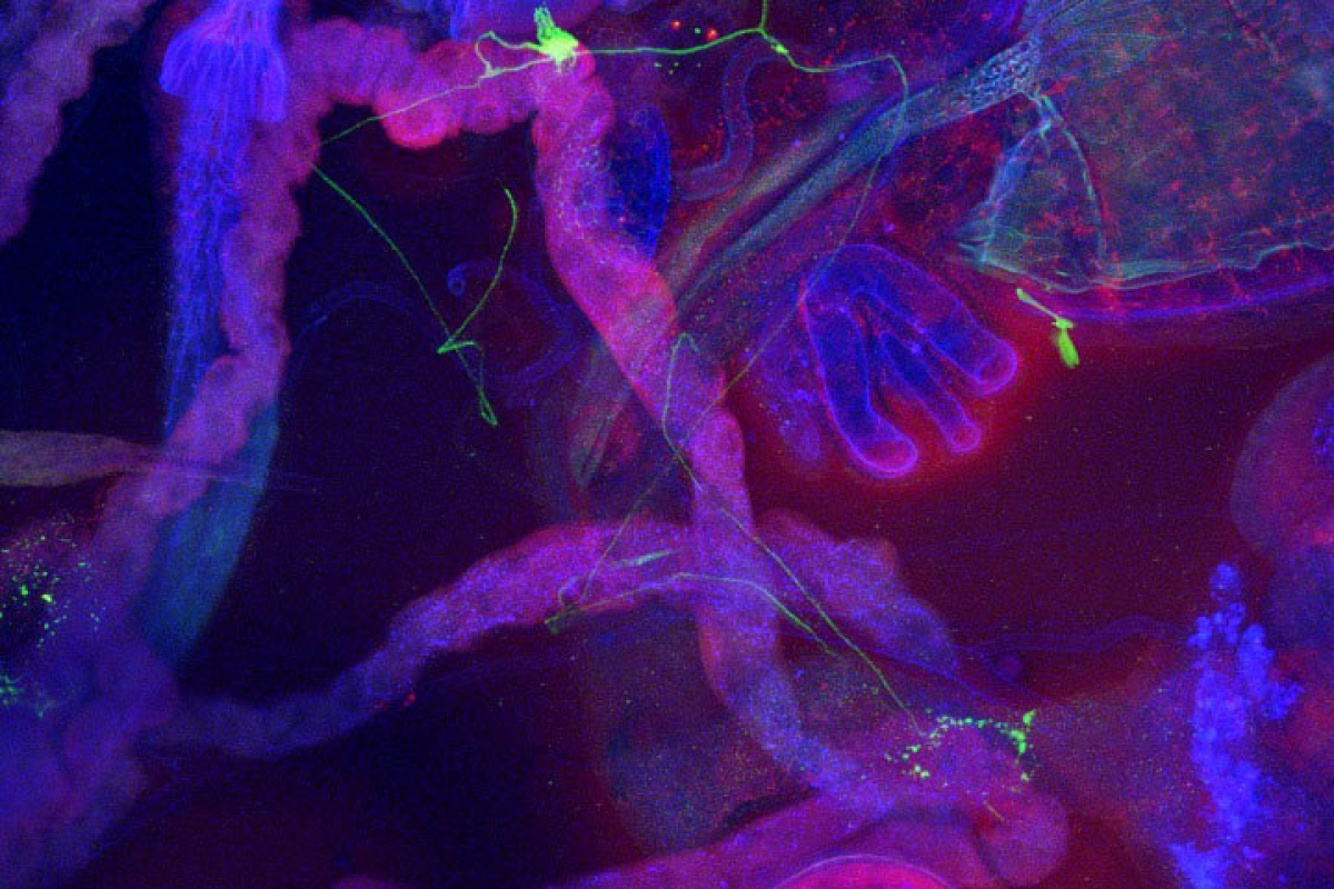  Teil des reproduktiven Systems mit Uterus der weiblichen Fliege