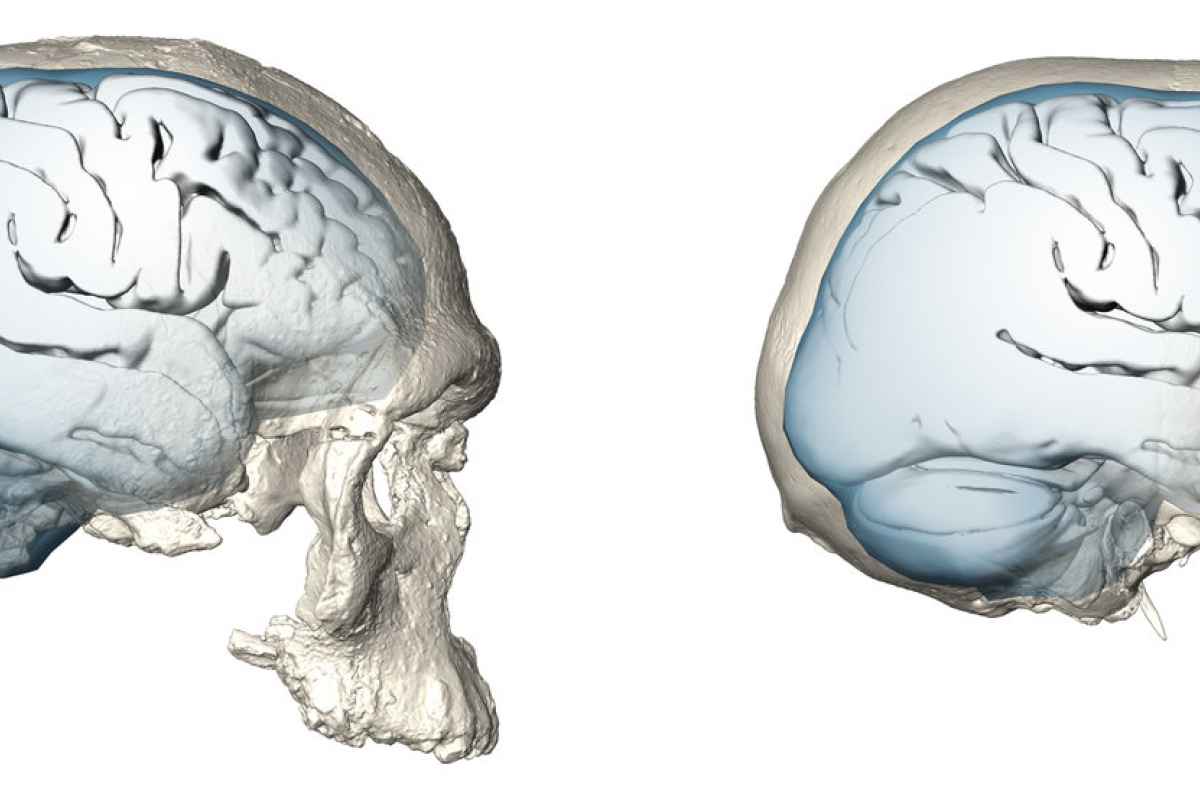 Evolution der Gehirnform bei Homo sapiens