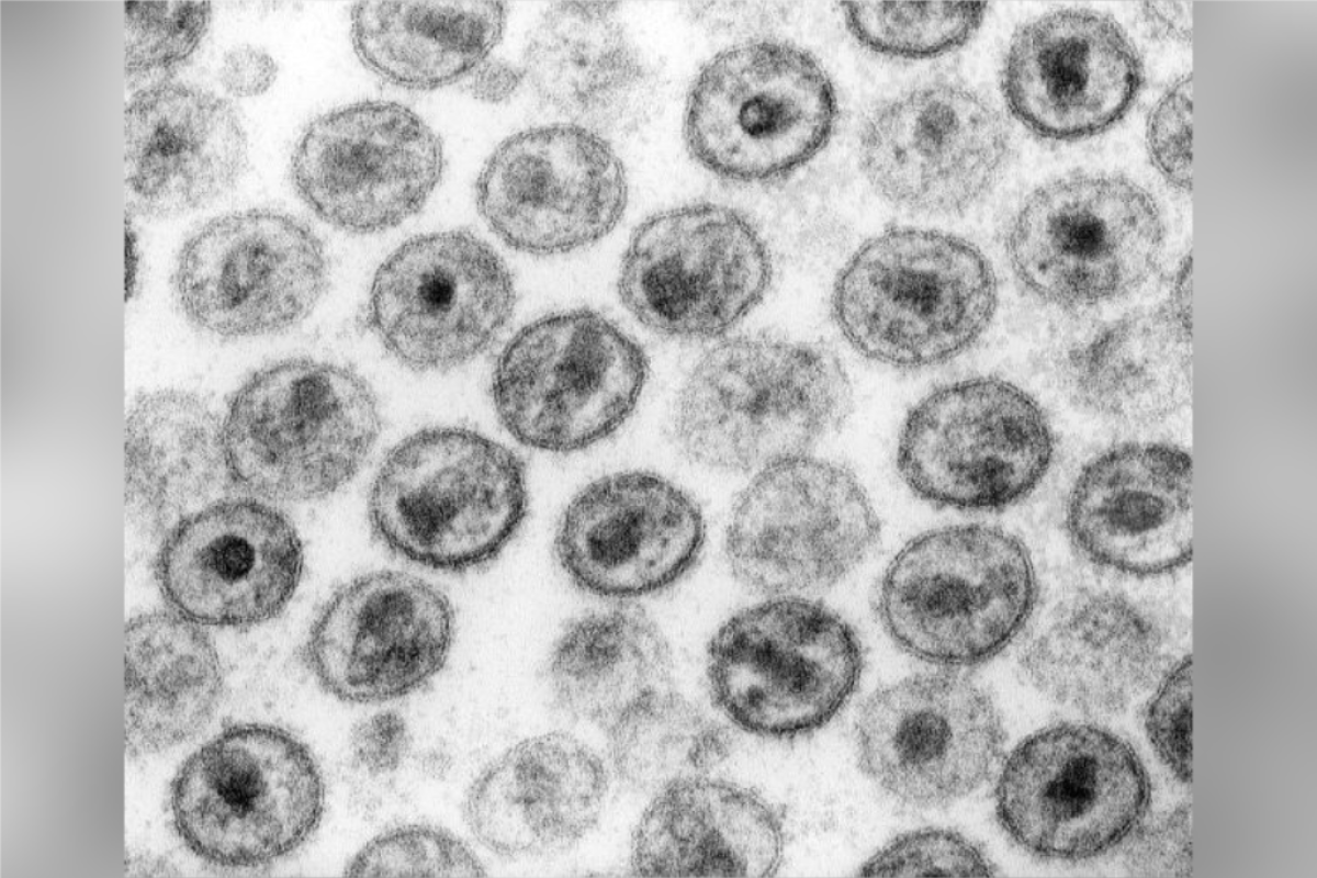 HIV-1. Transmission electron micrograph